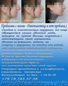 Ринопластика - изменить размер или форму носа Крым, Симферополь
